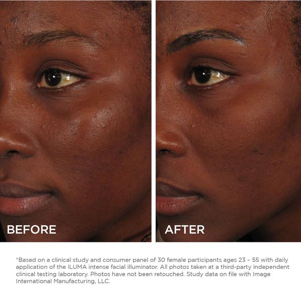  IMAGE Skincare, ILUMA Intense Brightening Serum, Helps