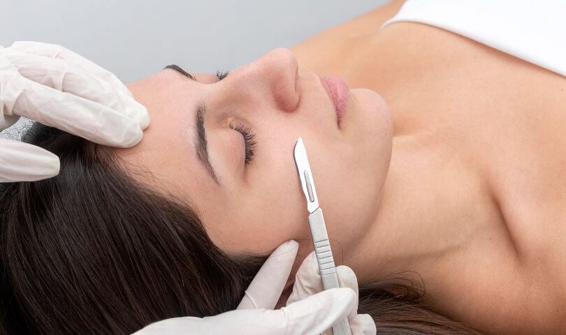 How Dermaplaning Removes Peach Fuzz and Dead Skin Safely