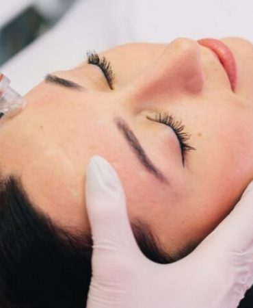 How-Often-Should-You-Get-an-Oxygen-Facial-for-Best-Results-810x480