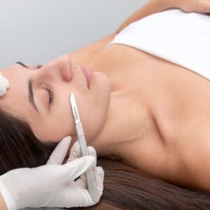 Dermaplaning for Acne-Prone Skin What You Need to Know