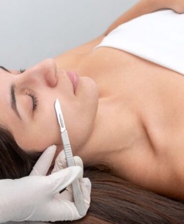 Dermaplaning for Acne-Prone Skin What You Need to Know