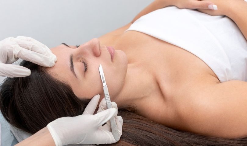 Dermaplaning for Acne-Prone Skin What You Need to Know