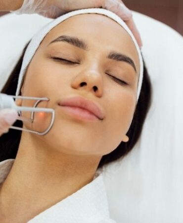 resurfacing facials herndon va